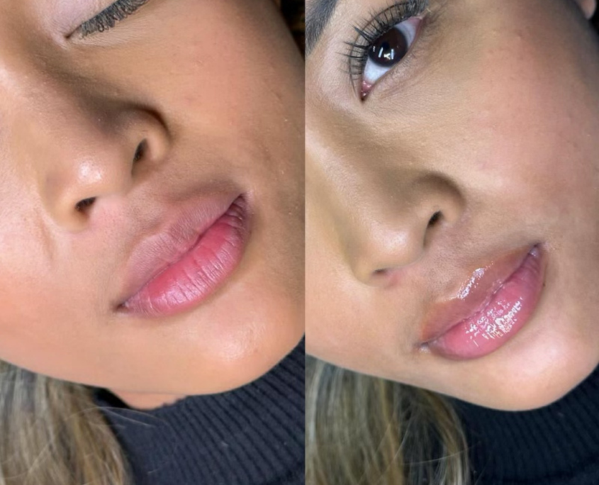 Hydragloss Lips Training